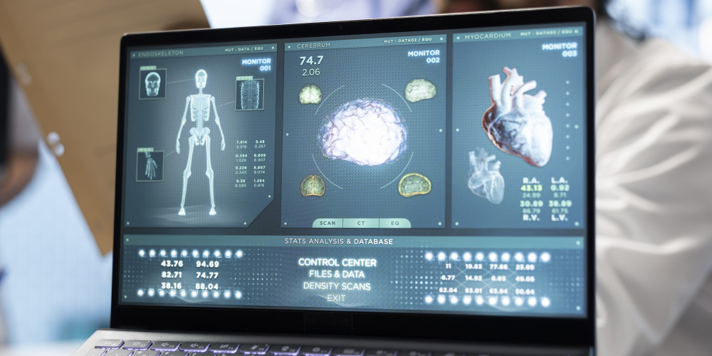 laptop scherm met medische afbeeldingen zoals lichaam en hersenen en een hart